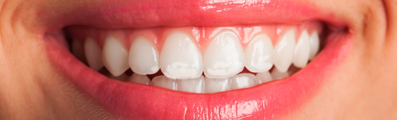 Manchas blancas en los dientes: qué son y cómo eliminarlas