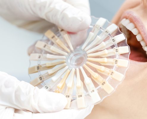 tratamientos de estética dental