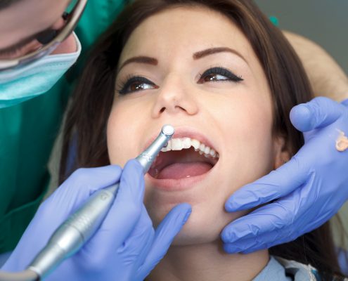 limpieza dental profesional