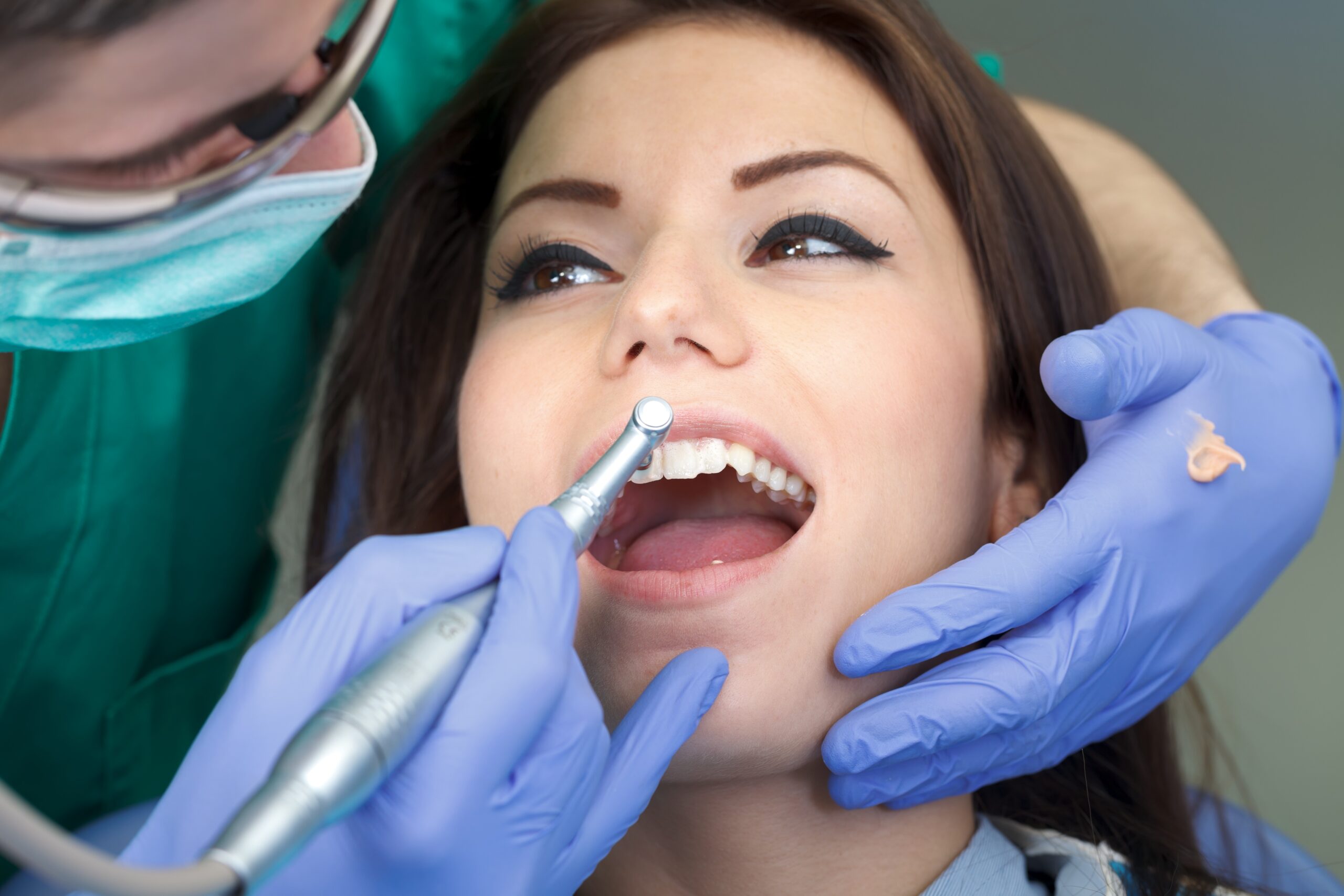 ¿Por qué es importante hacerse una limpieza dental profesional?