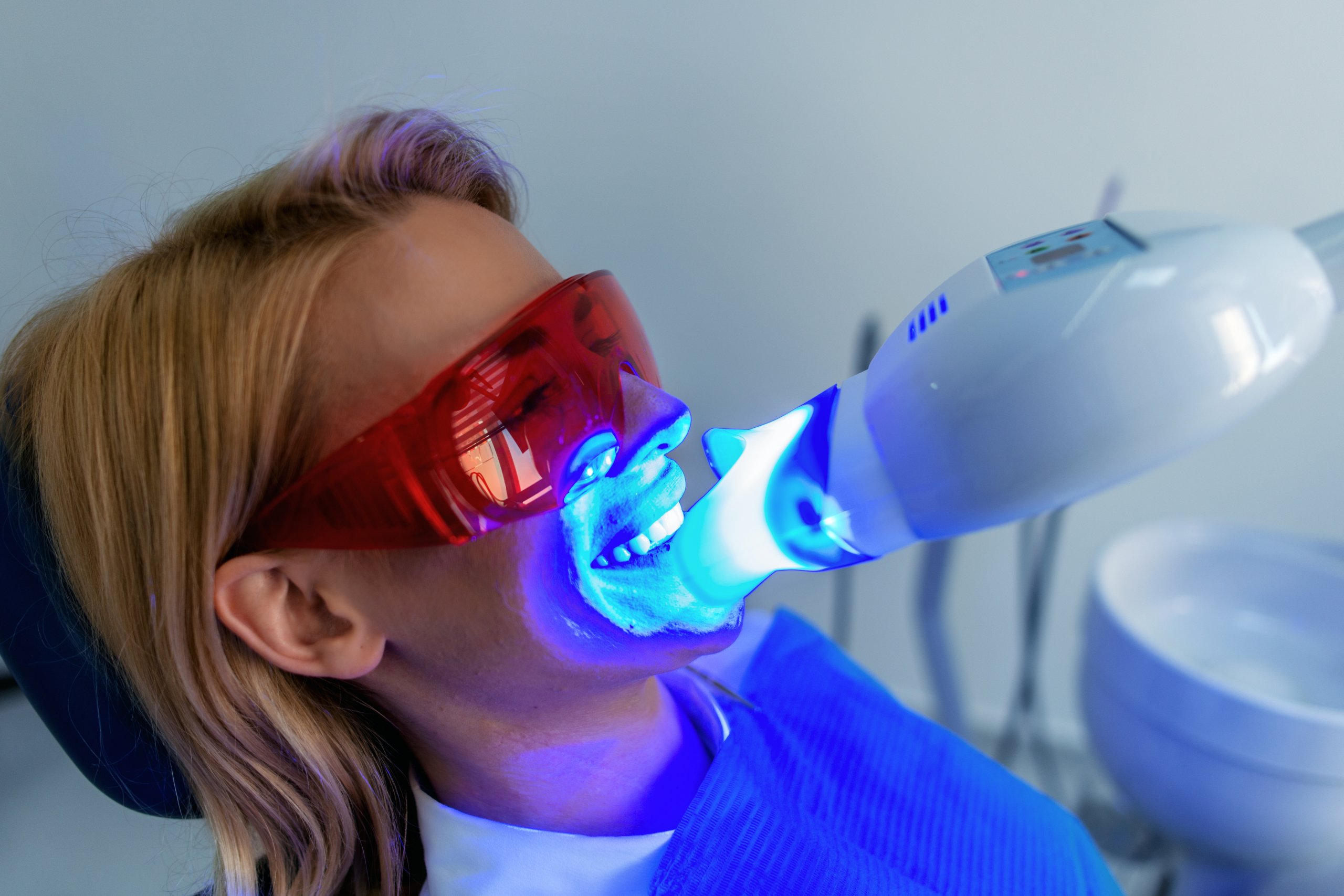 Blanqueamiento dental combinado: dientes más blancos durante más tiempo