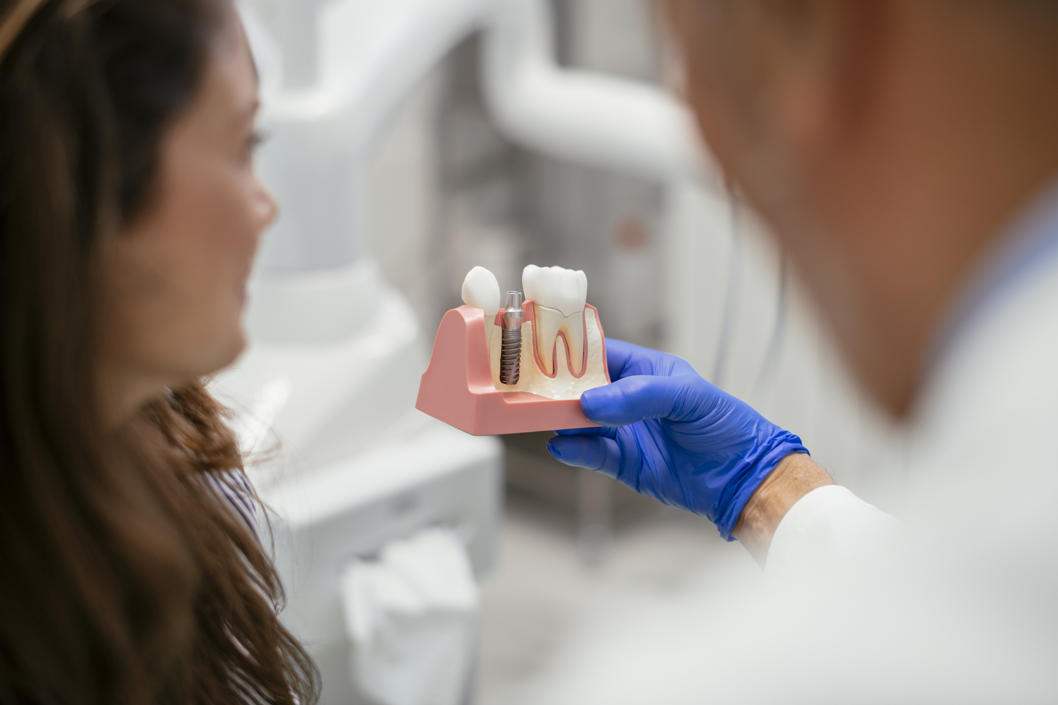 Implantes dentales: una solución permanente para la pérdida dental