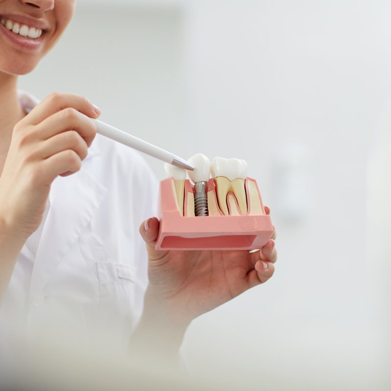 implante dental