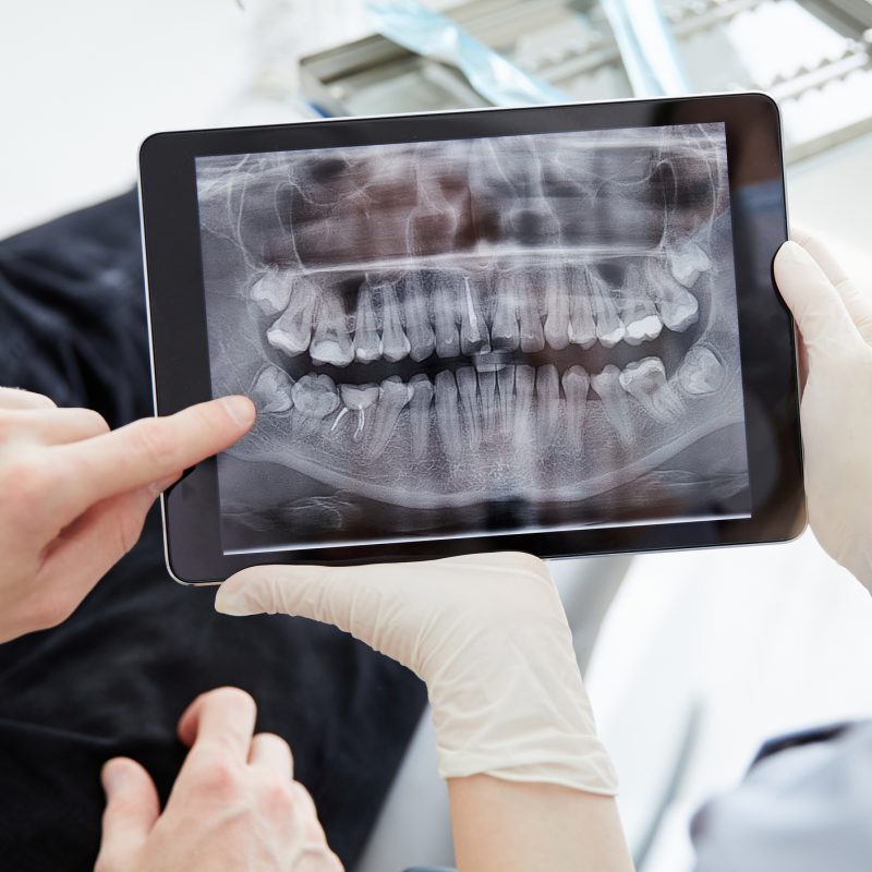 planificación digital dental